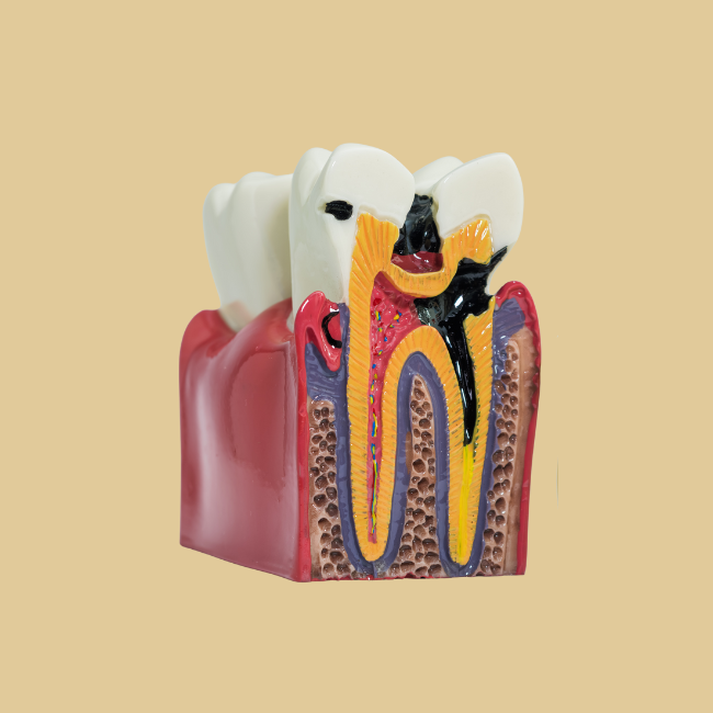 caries periodoncia en bravo murillo