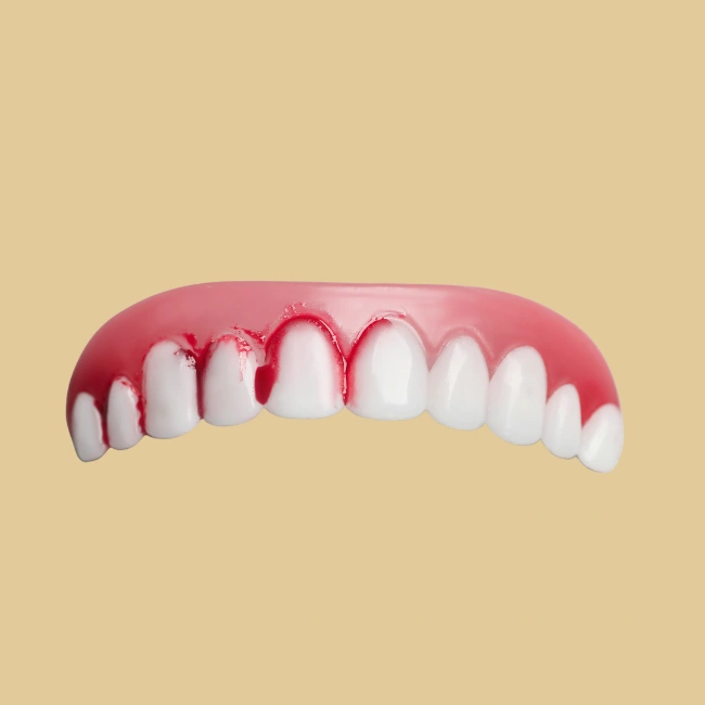 nuestro tratamiento de periodoncia en bravo murillo